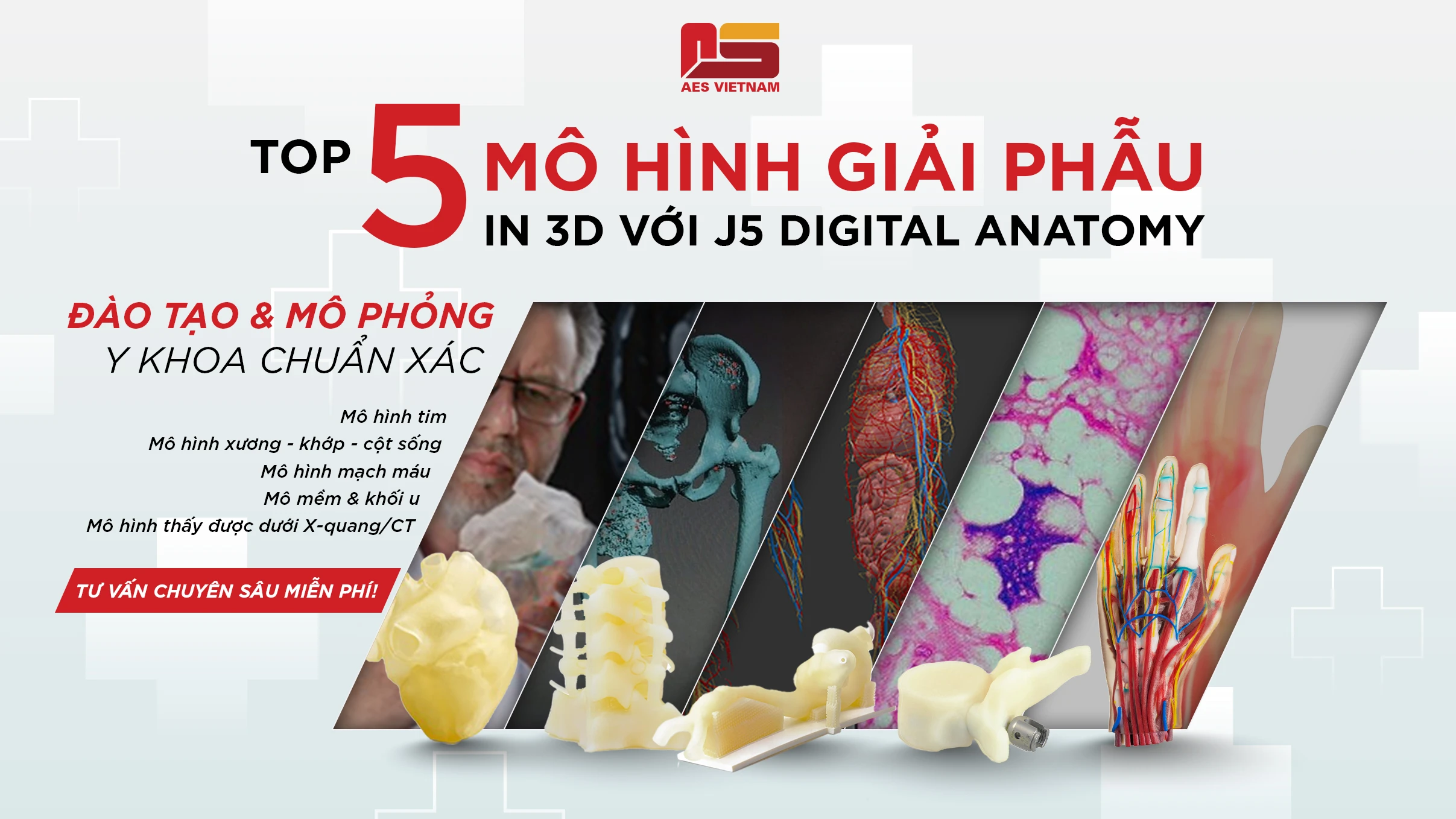 Top 5 Mô Hình Y Khoa Đột Phá Từ In 3D Với J5 Digital Anatomy